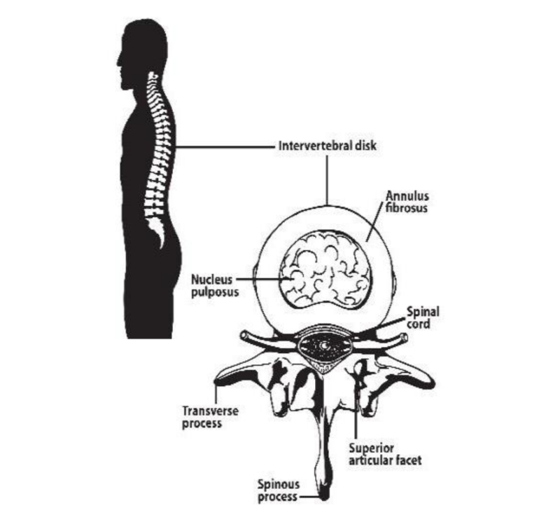 This diagram show the human back with the vertebrae and individual disks. Then a cross-section of a disc and Annulus fibrous. 